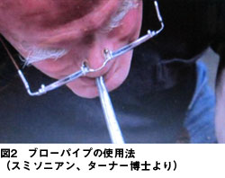 図2 ブローパイプの使用法(スミソニアン、ターナー博士より)